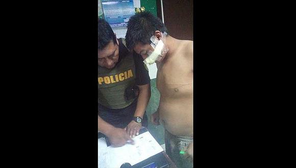 Tacna: Borracho se cortó la cara porque su ex pareja no lo dejó ver a su hijo     