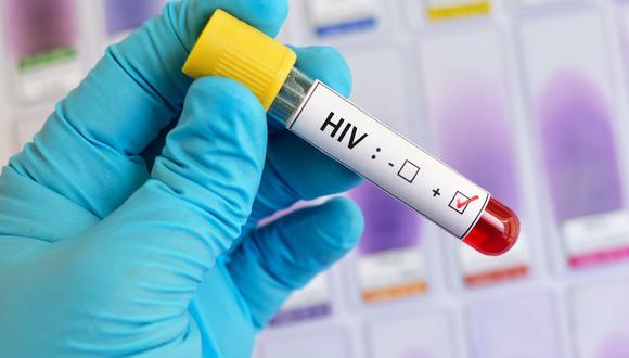 Las personas que hayan iniciado su vida sexual pueden acceder a pruebas de descarte de VIH.