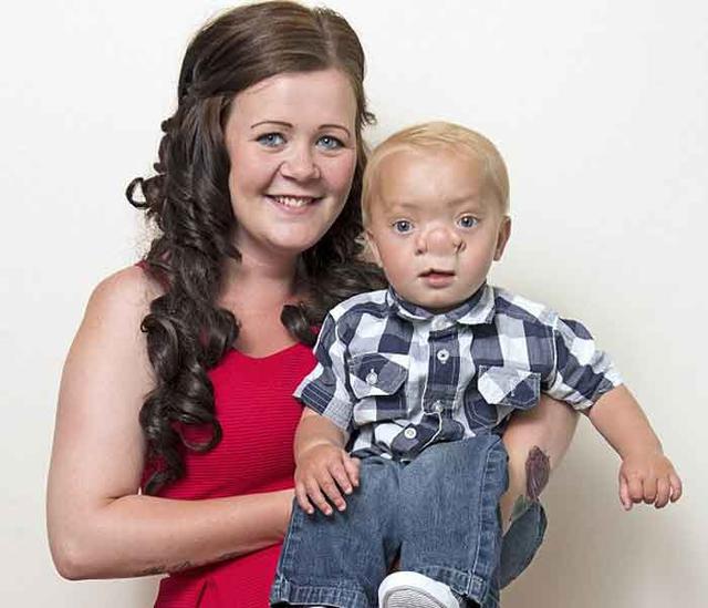 ​Esta es la conmovedora historia del "pinocho de la vida real" [FOTOS]