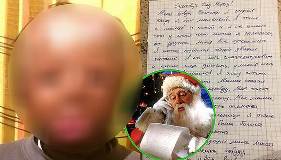 Niño de cinco años escribe emotiva carta a Papá Noel: "quiero una cara nueva"