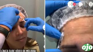Melissa Klug: filtran video de ella aplicándose botox para disimular las arrugas del rostro