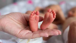 Brasil: nace bebé con dos penes y le extirpan el más grande