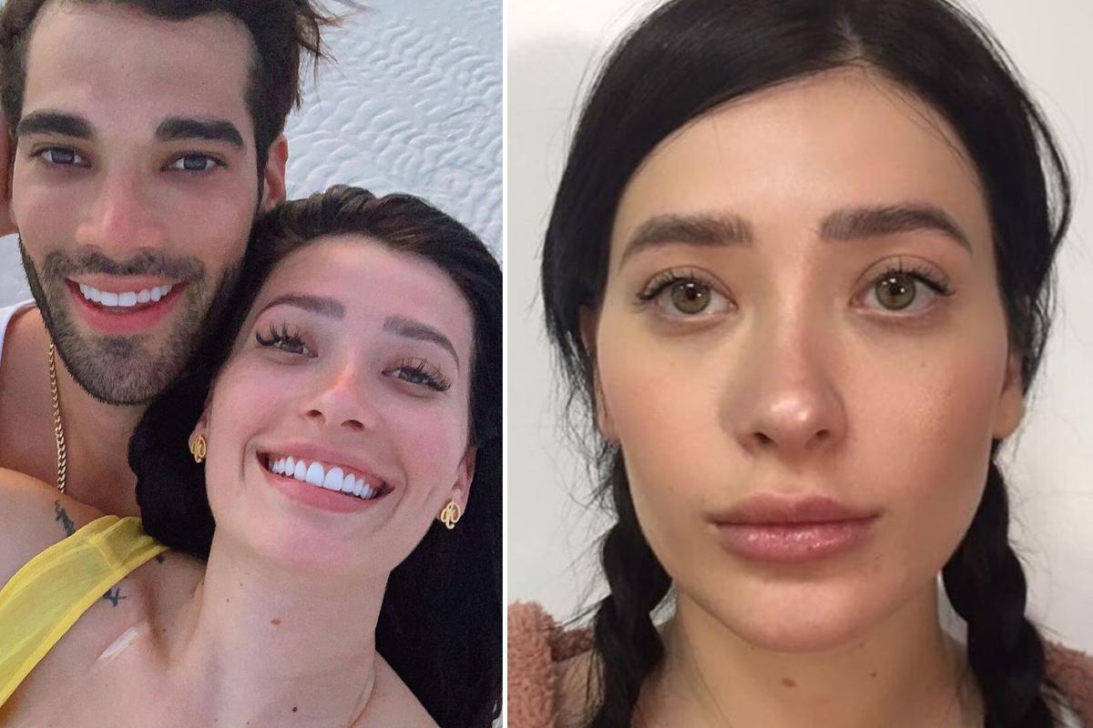 Guty Carrera: su novia Brenda Zambrano muestra su rostro tras operarse la  nariz por cuarta vez│FOTOS Web Ojo | OJO-SHOW | OJO