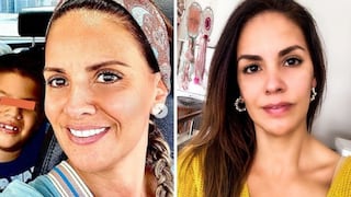 Blanca Rodríguez luce irreconocible y responde por aparente ‘arreglito’ en el rostro 