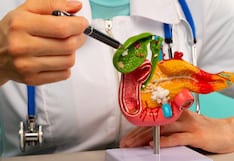 Comer para vivir: Qué son los cálculos en la vesícula y cómo evitarlos