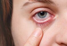 Evite infecciones oculares: consejos para cuidar su vista