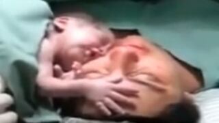 Recién nacido se "aferra" a su madre en el quirófano [VIDEO] 