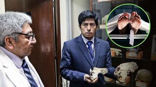 Morgue de Lima: forenses utilizan técnicas modernas para que no hayan cadáveres no identificados