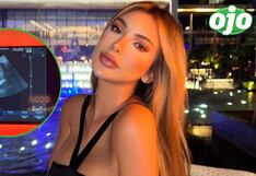 Paula Manzanal confirma su segundo embarazo: ¿Quién es el padre de su hijo? (VIDEO)