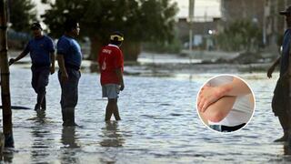Medidas de prevención de la leptospirosis