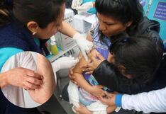 Piden vacunar a los niños tras caso confirmado de sarampión