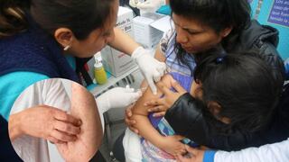 Piden vacunar a los niños tras caso confirmado de sarampión