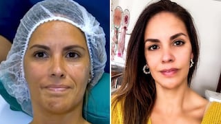 Blanca Rodríguez lo niega, pero así fue su rejuvenecimiento facial para eliminar arrugas│VIDEO