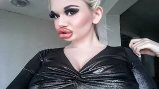“Barbie humana” anuncia que aumentará el tamaño de sus labios | FOTOS 