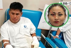 PJ ordena 12 meses de prisión preventiva a que prendió fuego a su pareja en Villa El Salvador