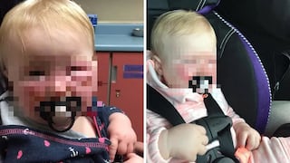 Madre denuncia que bloqueador en aerosol causó severas quemaduras a su bebé