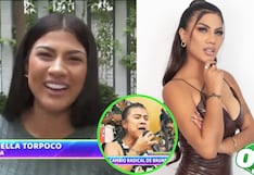 Mira el antes y después de Brunella Torpoco: ¿Cuánto gastó y que cirugías se ha hecho la salsera?