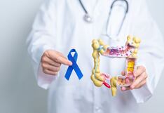 Aumentan los casos de cáncer de colon en adultos jóvenes