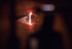 Glaucoma en el Perú: el ladrón silencioso de la vista que causa ceguera irreversible