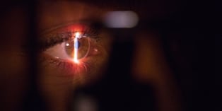 Glaucoma en el Perú: el ladrón silencioso de la vista que causa ceguera irreversible