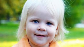 ¡Atención! ¿Qué factores influyen en el albinismo de la piel?