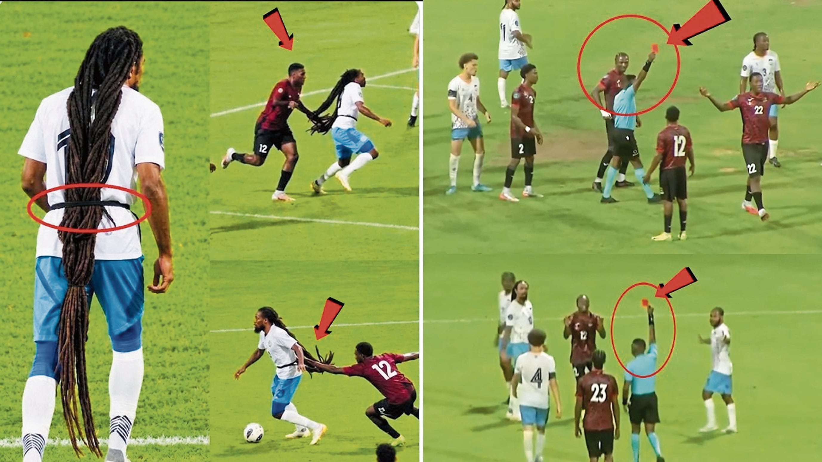 El pelucón Aedan Scipio, jugador de fútbol de la selección de Anguila, es visto como un caso único de pelo largo en el fútbol profesional y de selecciones.