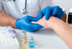 Alerta por casos de sarampión