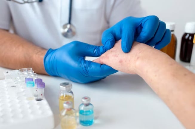 La mayoría de los contagios corresponde a menores de 18 años, incluidos cientos de niños pequeños. (Foto referencial: Freepik)