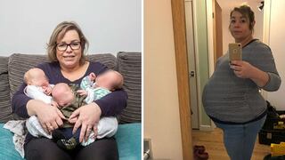 El extraño caso de una mujer que salió embarazada estando ya embarazada 