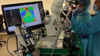 Robot cirujano opera con más precisión que médicos reales 