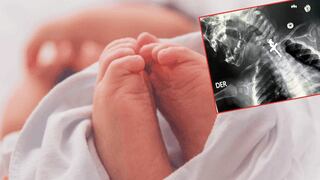 Salvan a bebé que se tragó crucifijo