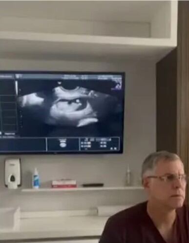 Cómo reaccionó Jesús Barco al escuchar los latidos de su bebé. Foto: América TV).