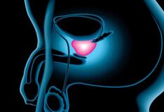 Día Mundial del Cáncer de próstata: Mitos y verdades que debes tener en cuenta