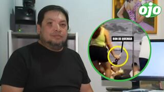 Fotógrafo de sesión que dejó a niño quemado: “No hemos tenido extintores porque ha sido al aire libre”