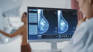 Piden acelerar ley para que municipios adquieran mamógrafos y ayuden a detectar casos de cáncer de mama