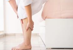 Vivir con várices: riesgos, síntomas y tratamientos para esta condición