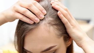 Comer para vivir: Hierro y caída del cabello en la perimenopausia