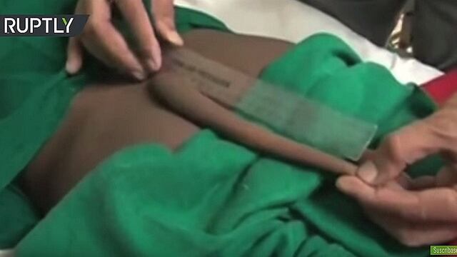 YouTube: Le cortan "colita" de 18 centímetros a joven e imágenes impactan [VIDEO]
