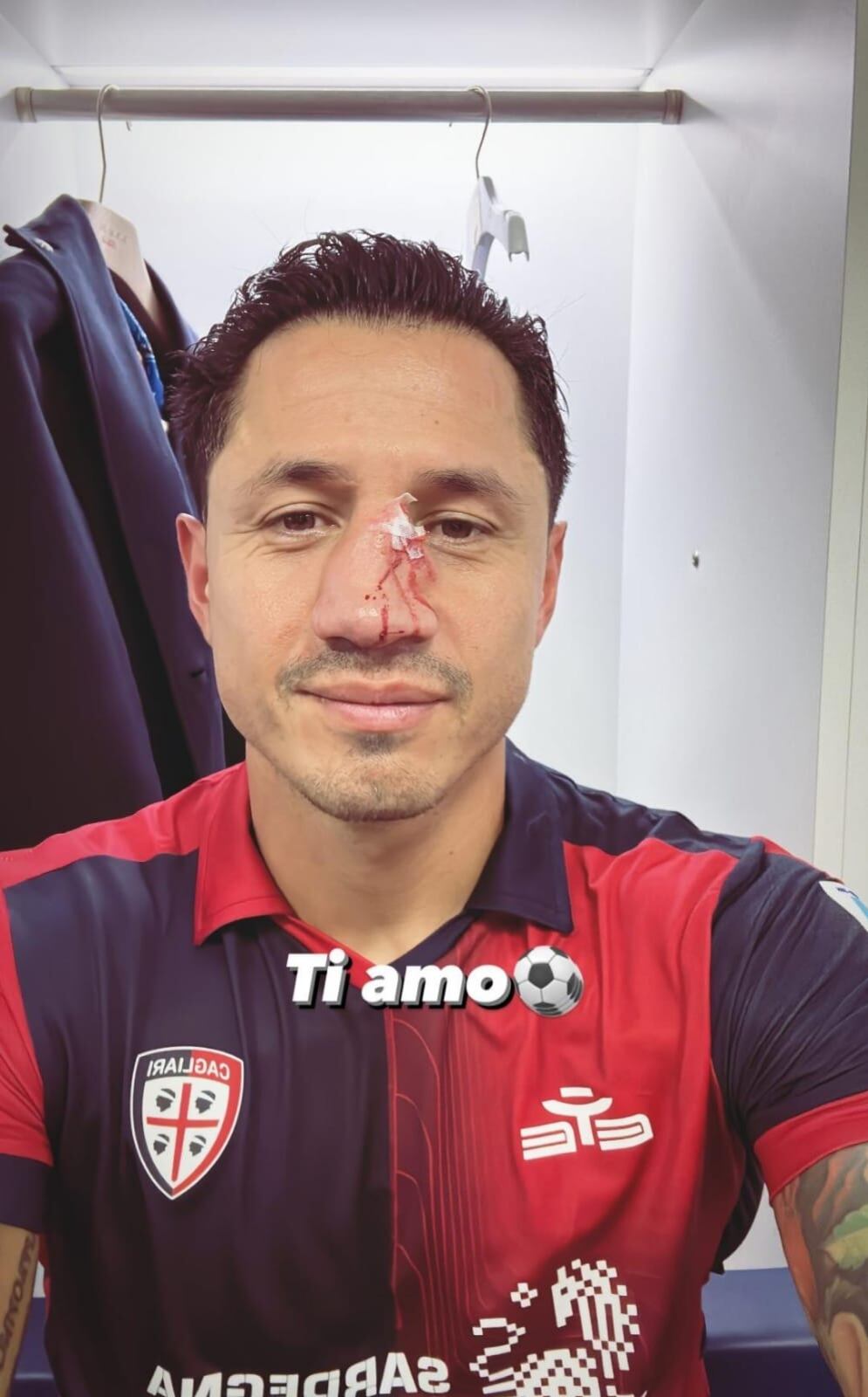 Lapadula subió una foto de su nariz al Instagram.