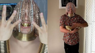 El impactante look de un rapero que se puso implantes de cadenas de oro como cabello