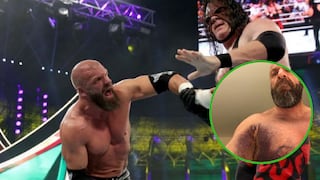 Triple H se someterá a cirugía tras ganarle a Undertaker y Kane en reciente evento de la WWE (FOTO)