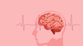 ¿Cuáles son los síntomas de un accidente cerebrovascular?
