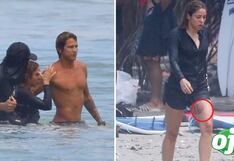 Detalles del reciente accidente de Shakira en la playa