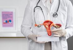 ¿Qué es la endometriosis? Cómo gestionar y controlar la enfermedad