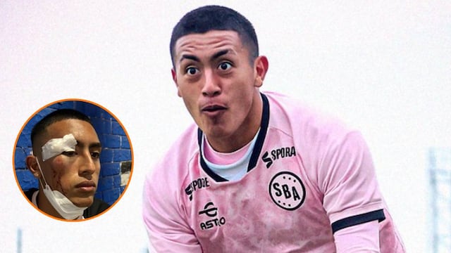 Hinchas de Sporting Cristal hieren a futbolista de Sport Boys y a sus familiares