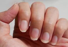 La columna de Pérez Albela: Uñas frágiles y las señales que el cuerpo nos envía