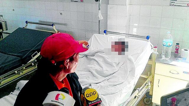 Chimbote: Madre quema con agua hirviendo a su hijo por portarse mal      