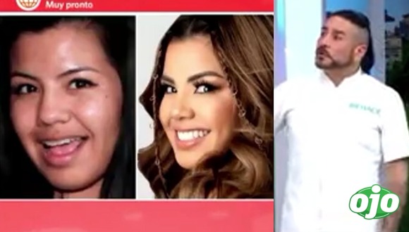 Cirujano compara a Estrella Torres y Andrea San Martín: "Estrella estaba abandonadita"