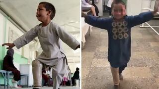 El enternecedor baile de un niño víctima de la guerra tras recibir una "nueva pierna" (VIDEO)