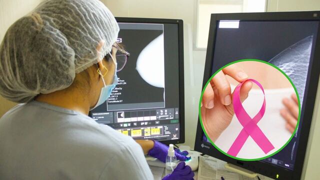 Cáncer de mama: Organizan campaña de detección y despistaje en Hospital Santa Rosa